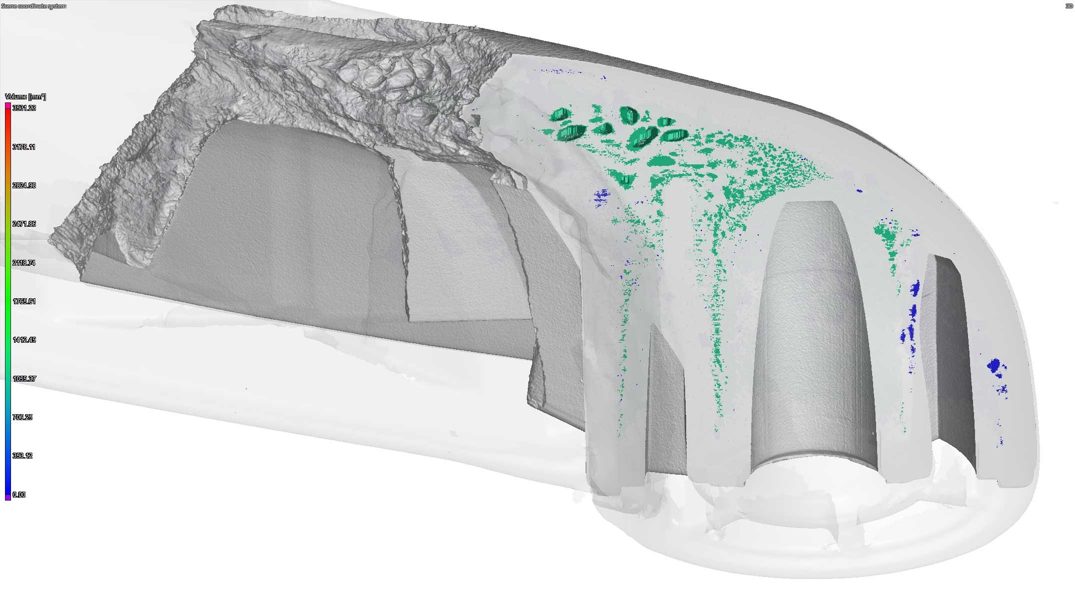 3D Rendered Foot Porosity