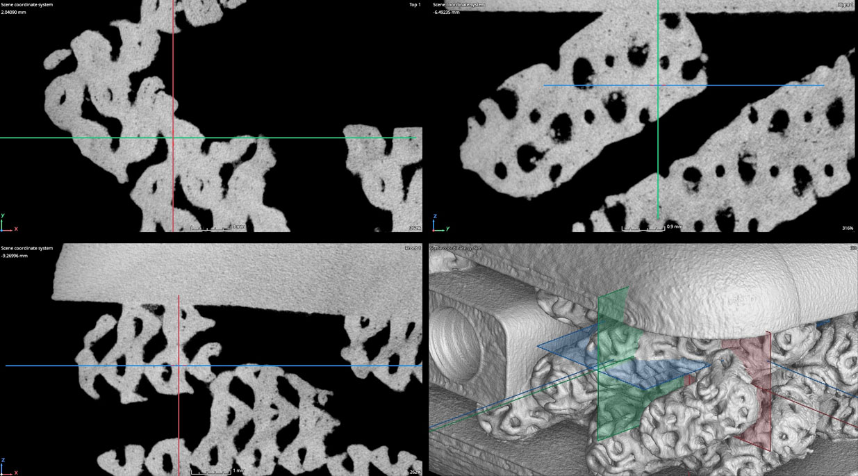 AM 3d printed CT Scan Slice 2