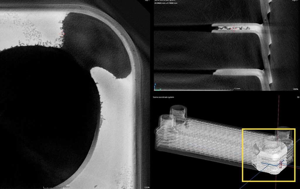 CT Scan HX