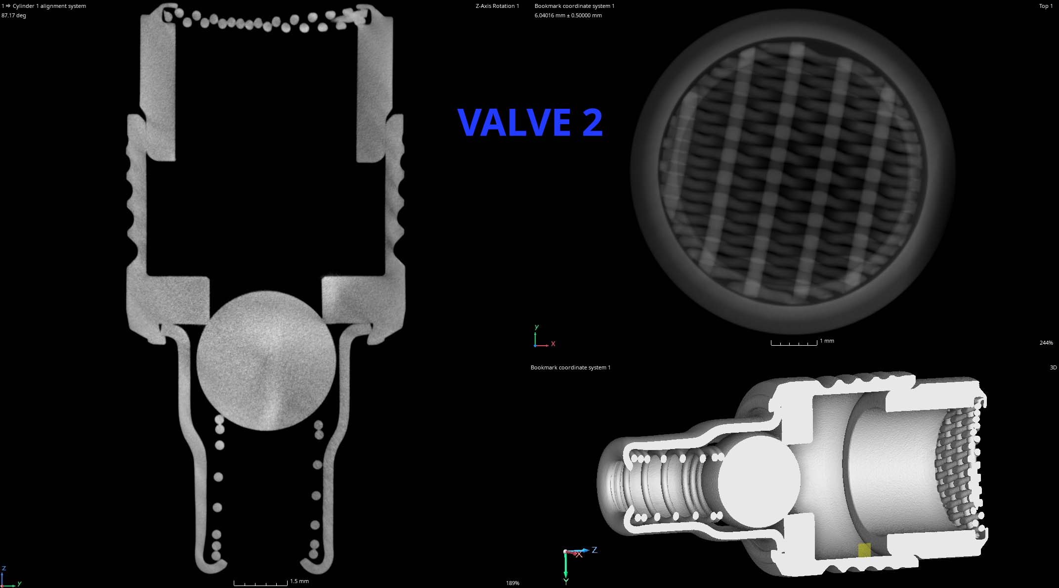 Check Valve CT Scan Pc 2