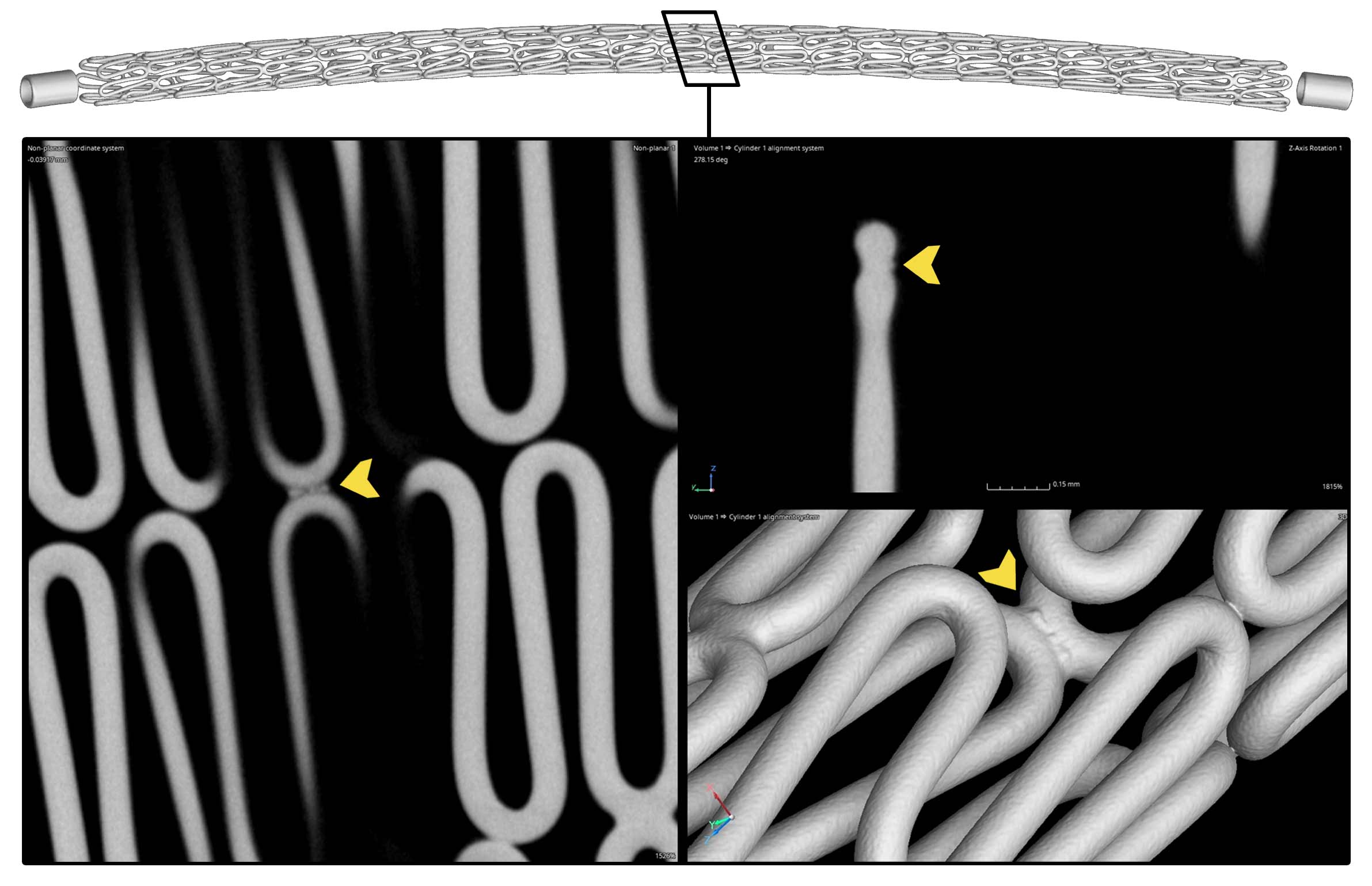 Stent Weld Profile CT Scan