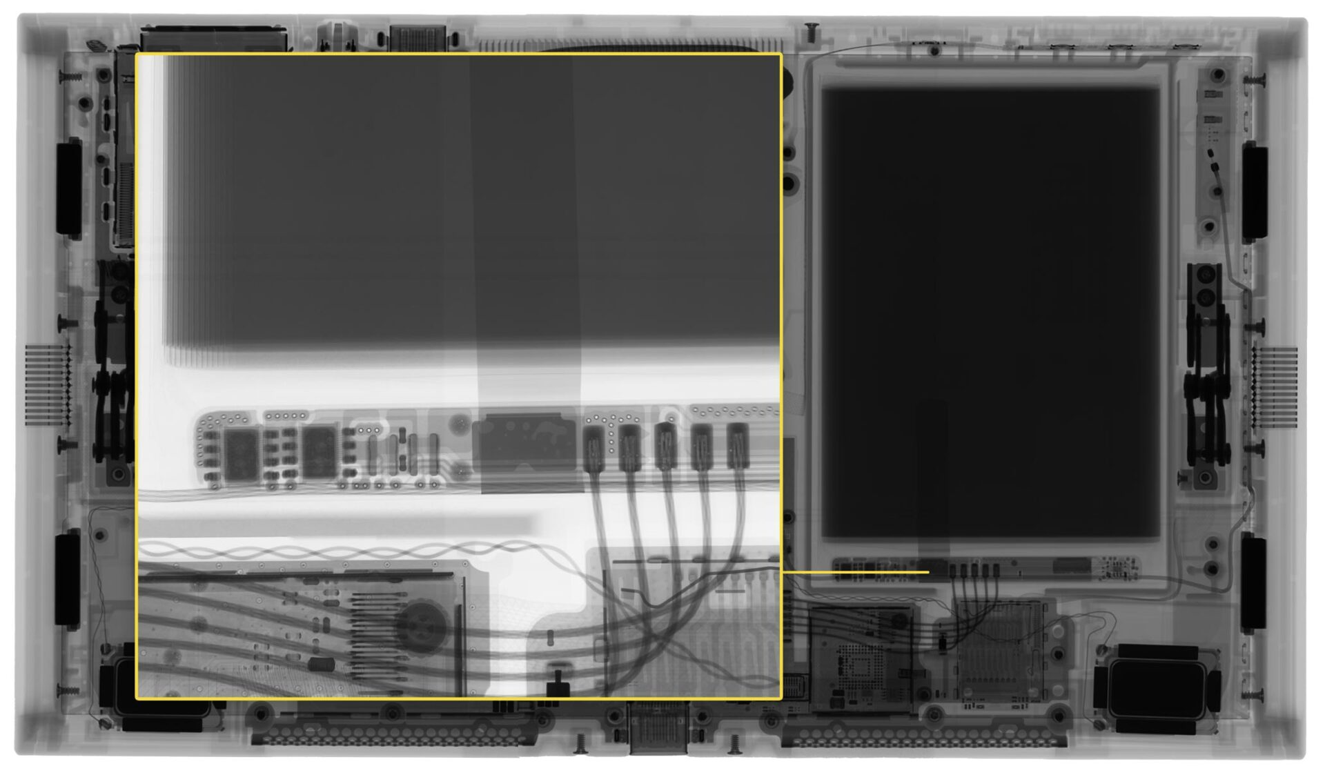 High Res Digital Radiography Switch 2 - 1
